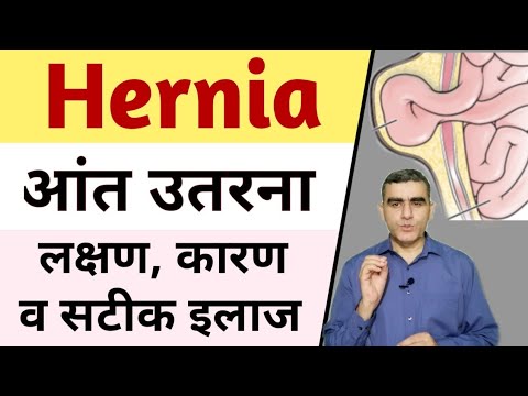 Hernia Symptoms | Hernia Ke Lakshan | Hernia ka Ilaaj |  Hernia Treatment Without Surgery