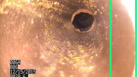 Automated Fracture Detection