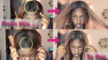 HOW TO: FIX BALDING CLOSURE !! | Make Your Closure Look Brand New ft. Ali Grace Hair