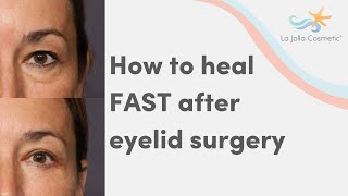 How to heal FAST after eyelid surgery