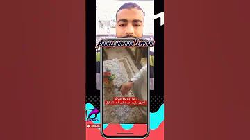 شوف البلاصة منين جلد السحر ميطيحش على البال 