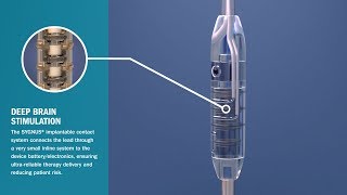 Contacts That Advance Neuromodulation Device Design by BalSealEngineering 395 views 5 years ago 1 minute, 27 seconds