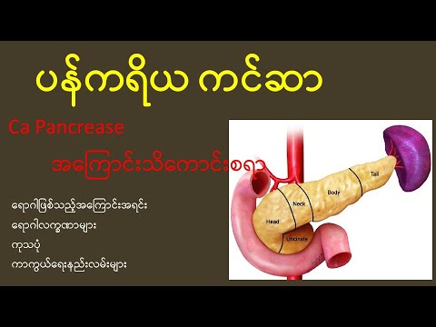 ပန်ကရိယကင်ဆာ CA pancreas အကြောင်းသိကောင်းစရာ