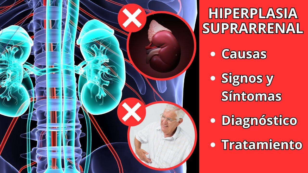 Insuficiencia Suprarrenal Qu Es S ntomas Causas Y Tratamiento MEMHZL insuficiencia-suprarrenal-qu-es-s-ntomas-causas-y-tratamiento-memhzl