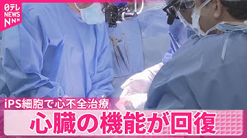 【世界初の治験】iPS細胞で心不全治療  心臓の機能が回復  大きな副作用なし…