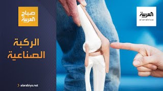 صباح العربية | استبدال مفصل الركبة بتقنية الطباعة ثلاثية الأبعاد