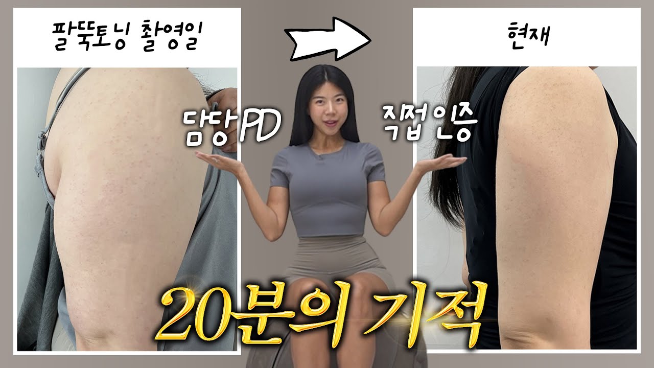 실제효과💪하루 단 20분! 팔뚝이 정말 달라집니다 (팔뚝토닝)