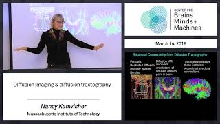8.2 - Diffusion Imaging Diffusion Tractography