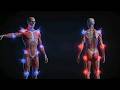 Fibromyalgie | Comment votre nerveux système se trompe