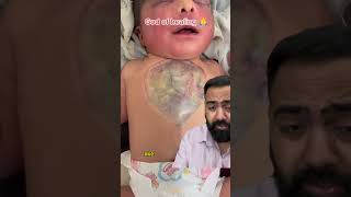 Doctor Reacts To Baby With Exposed Heart!