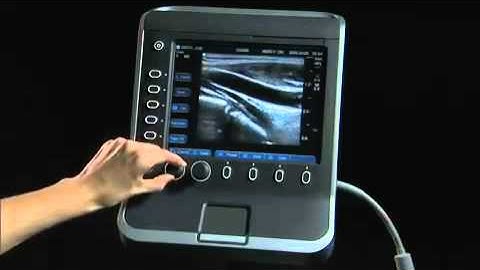 Sonosite S Series Product Training Part 1: System Overview