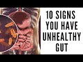 10 Signs You Have Unhealthy Gut  - Common Gut Problems That May Affect Your Overall Health