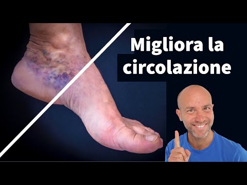 Video: 3 modi per migliorare la circolazione ai piedi
