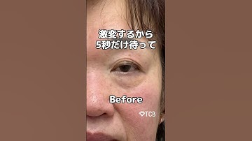 【クマ取り】5秒だけ待って！#shorts