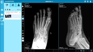 [Arabic] Chapter 5 - Lesson 7 - print x ray image on film - تعلم طباعة صور الأشعة وجرب بنفسك screenshot 5