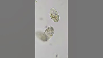 Exocytosis (or microbial pooping)  #microscopy #science