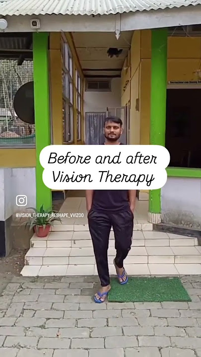 Vision Therapy for Squint eyes #visiontherapyworks