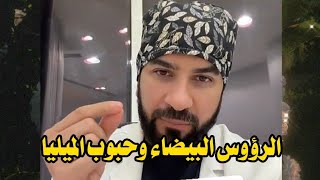 علاج الرؤوس البيضاء في الوجه و الحبوب الميليا تحت العين