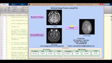Medical Image fusion using PCA Matlab Project Source Code