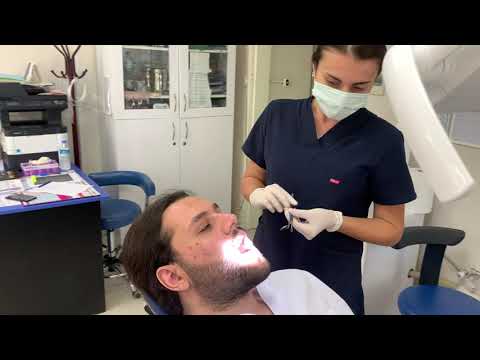Video: Diş Hekimine Nasıl Başvurulur