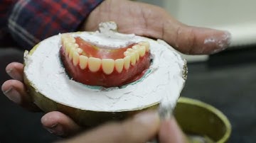 Essentials of Dental Materials Chapter 6 -  Compression moulding technique