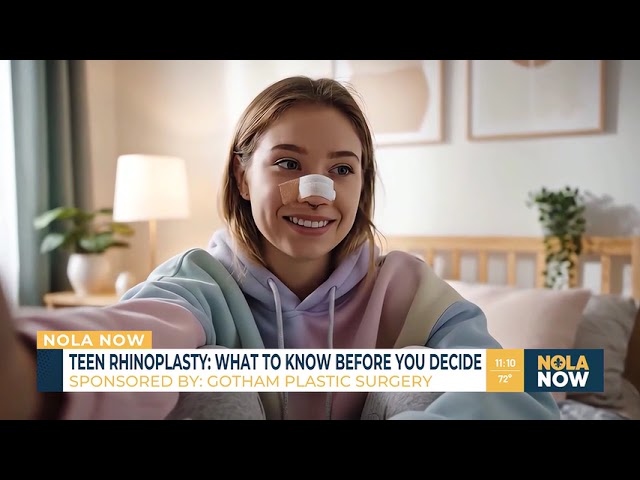 What to know before you decide on teen rhinoplasty | NOLA Now