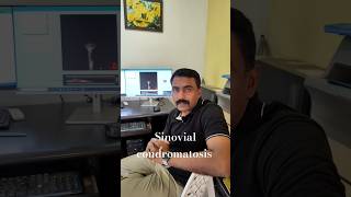 Joint Mice In The Tmj Cbct Finding In 60 Seconds