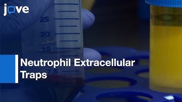 Neutrophil Extracellular Traps (NETs) Isolation and Handling | Protocol Preview