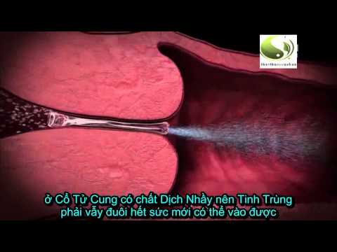 Video: Các Tư Thế Thụ Thai Khi Uốn Cong Tử Cung