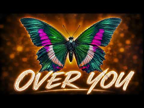 Nathan Dawe x Shayan – Over You (Deep House Remix)