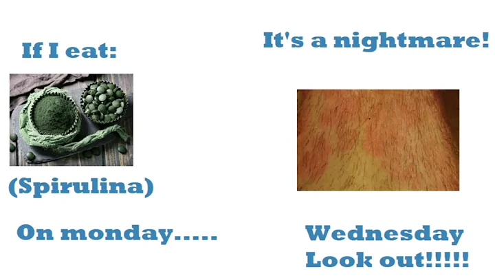 Psoriasis and BIOMARKERS(There is ONLY ONE)