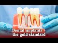 Dental implants, the gold standard at Esteem Dental Clinic