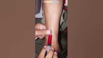IV Injection Training video #ivinjection #intravenousinjection #medicalprocedure #viralvideo