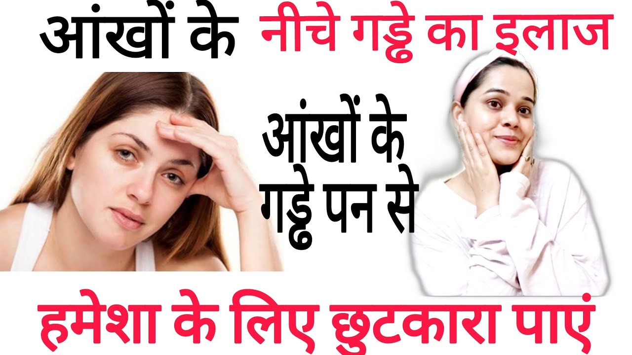 आंखों के नीचे गड्ढे का इलाज,Be happy Priyanka - YouTube