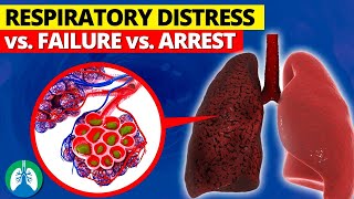 Respiratory Distress vs. Failure vs. Arrest | EXPLAINED 🫁