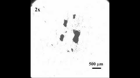 Tiny nanobot swarm makes in vivo human surgeries possible
