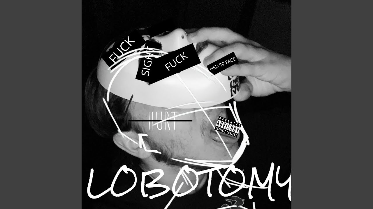 Watch Lobotomy on YouTube Watch Lobotomy on YouTube