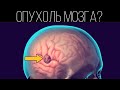 Опухоль головного мозга? | ПОЛЕЗНЫЙ ЮТУБ