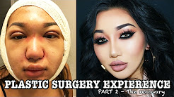 MY PLASTIC SURGERY STORY pt 2 | Double eyelid, Rhinoplasty, Chin liposuction