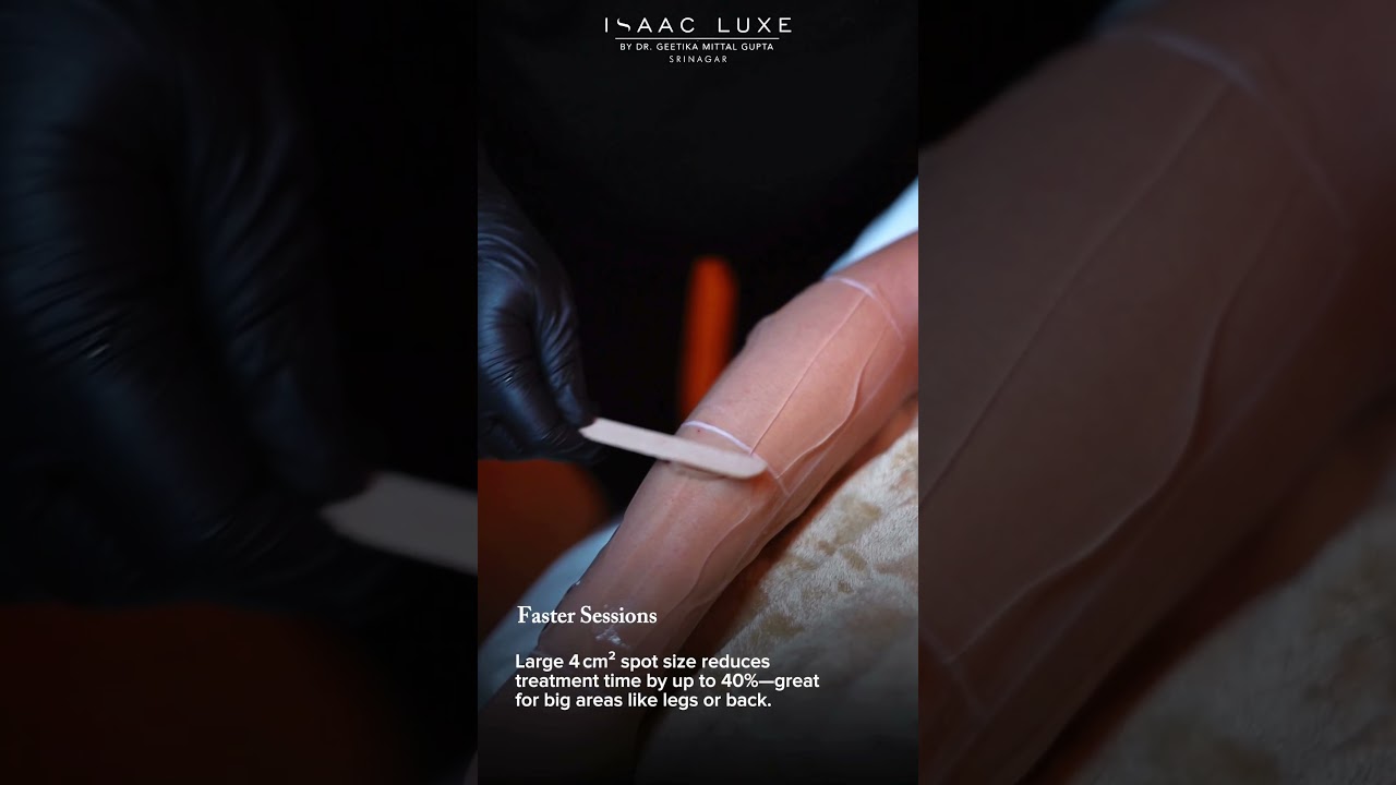 Ditch the wax. Glow with laser! Silky-smooth, pain-free, and permanent — only at ISAAC Luxe Srinagar