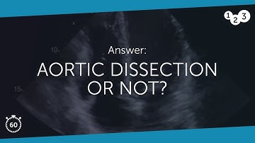 60 Seconds of Echo Teaching Answer: Aortic Dissection or not?