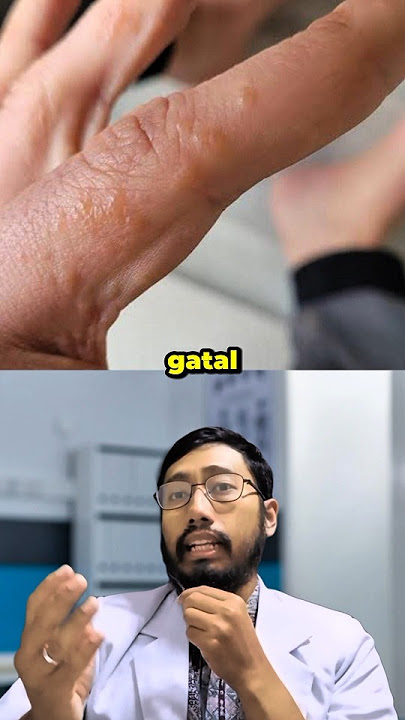 😭 GATAL BANGET‼️gelembung isi cairan, TERNYATA INI SEBABNYA 😱 #faktaunik #faktakesehatan