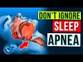 What Happens To Your Body When You Have Sleep Apnea?