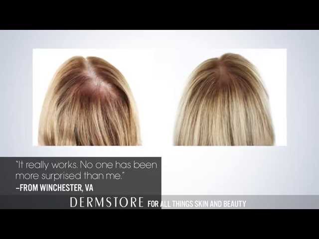 The Best Treatment for Thinning Hair - thptnganamst.edu.vn