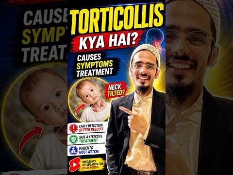 Baby Gardan Tedhi? ⚠️ Ye Ho Sakta Hai Torticollis #shortsfeed
