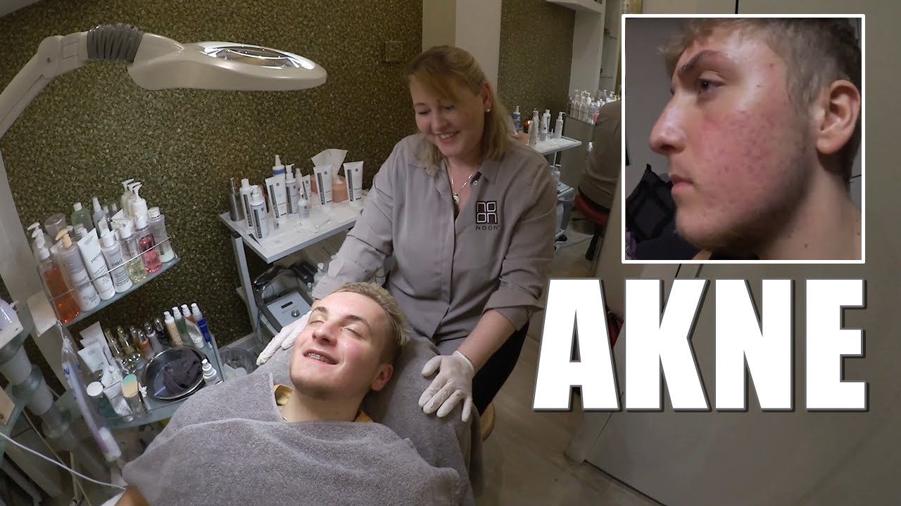 New Update KOSMETIK-Behandlung für AKNE, Narben, Hautprobleme, Rötungen \u0026 Tipps zur Pflege | NOON