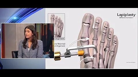 PIX11 New York's Very Own with Dr. Haller