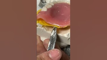 How to reline dentures!