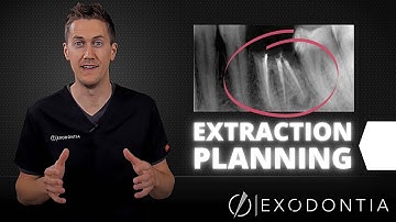 How To Extract Teeth Successfully Every Time | OnlineExodontia.com