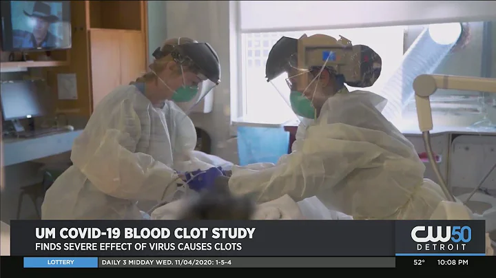 Researchers At U-M Say They Have Identified New Cause Of Blood Clots From Covid-19 - DayDayNews